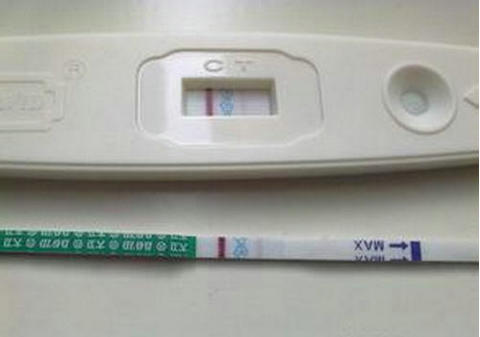 顕微授精 ICSI